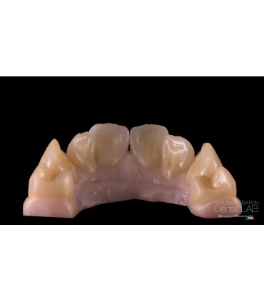 DMAX Multilayer Smart