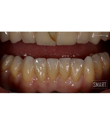 DMAX Multilayer Smart