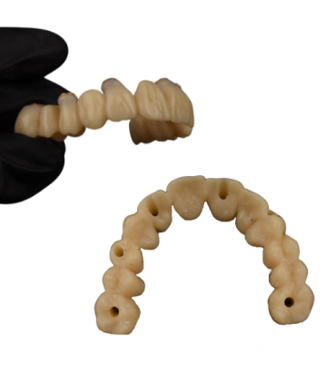 Pack impresión 3D - Impresora Phrozen 3D Sonic XL 2022 + Resina dental Crowntec